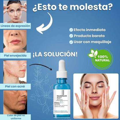 💖SÉRUM WEST&MONTH B5 CON EFECTO BÓTOX INMEDIATO + REGALO! ⏳